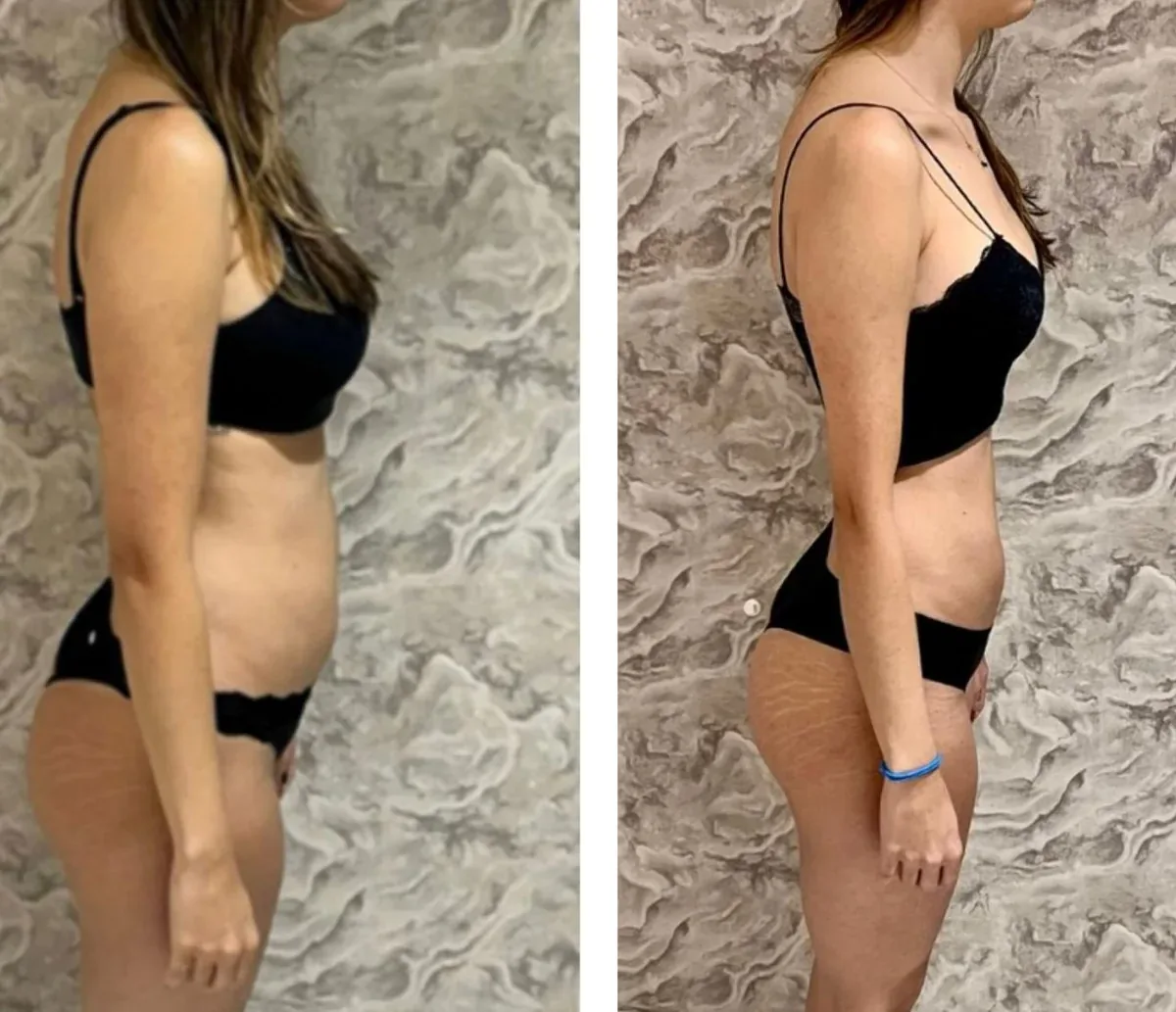 Registro real de acompanhamento nutricional em colagem