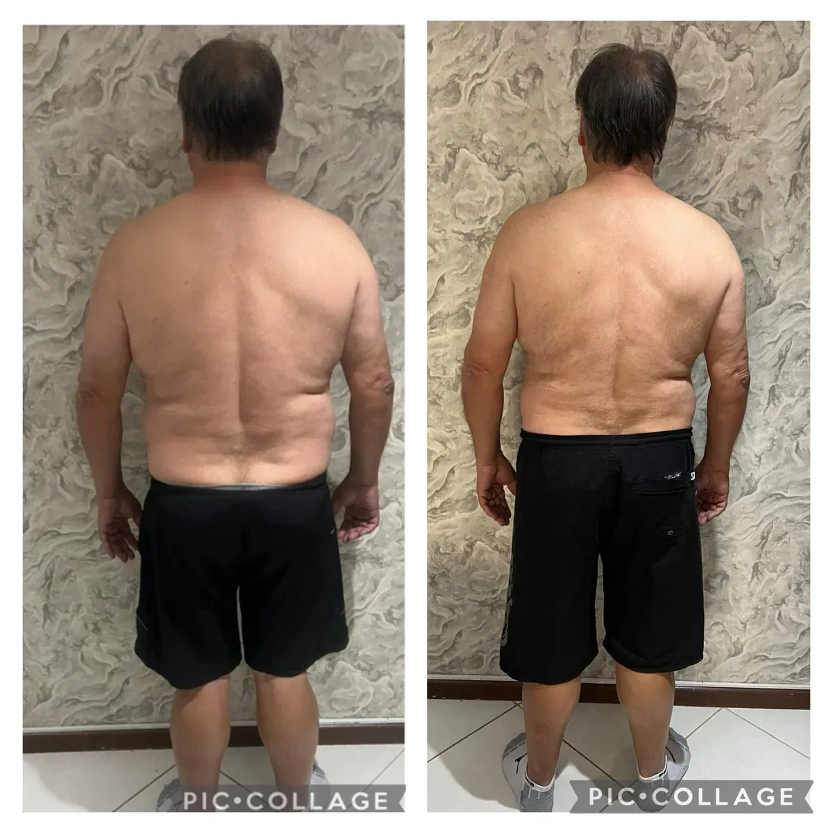 Paciente acompanhado pela Gabinutri em sua rotina nutricional