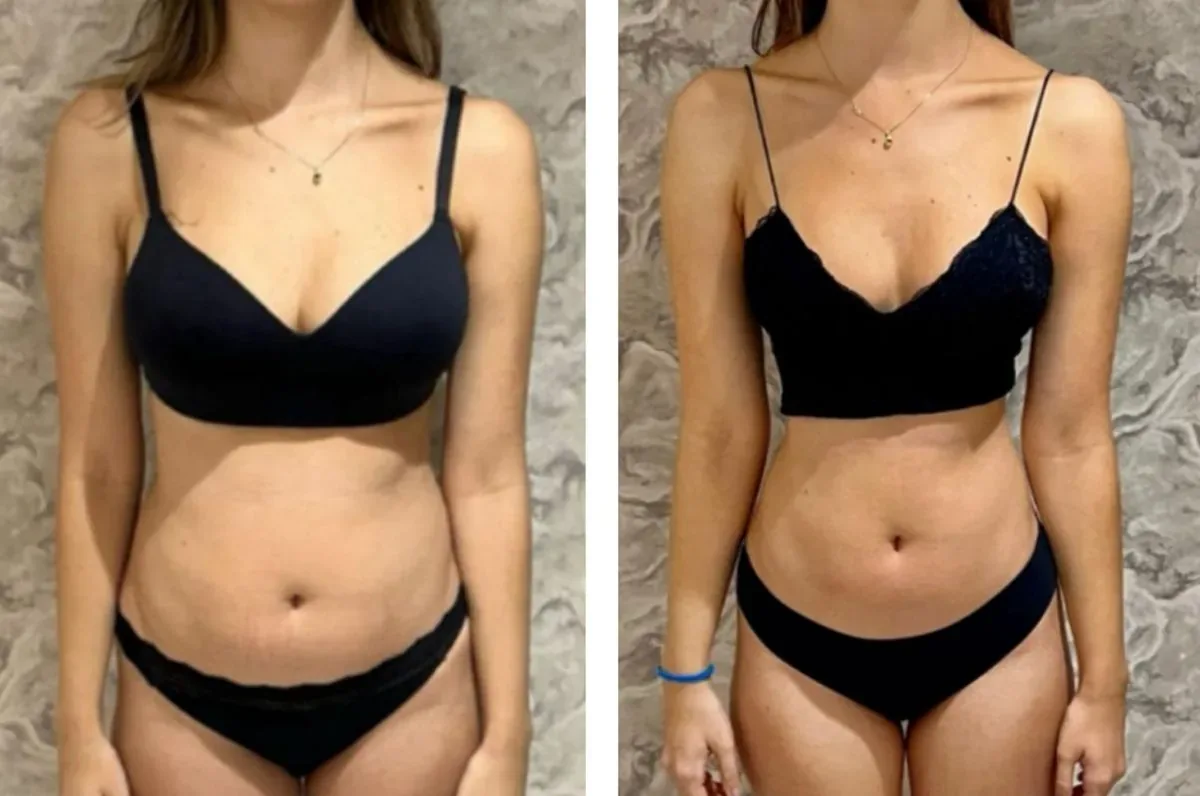 Registro real de acompanhamento nutricional com acolhimento