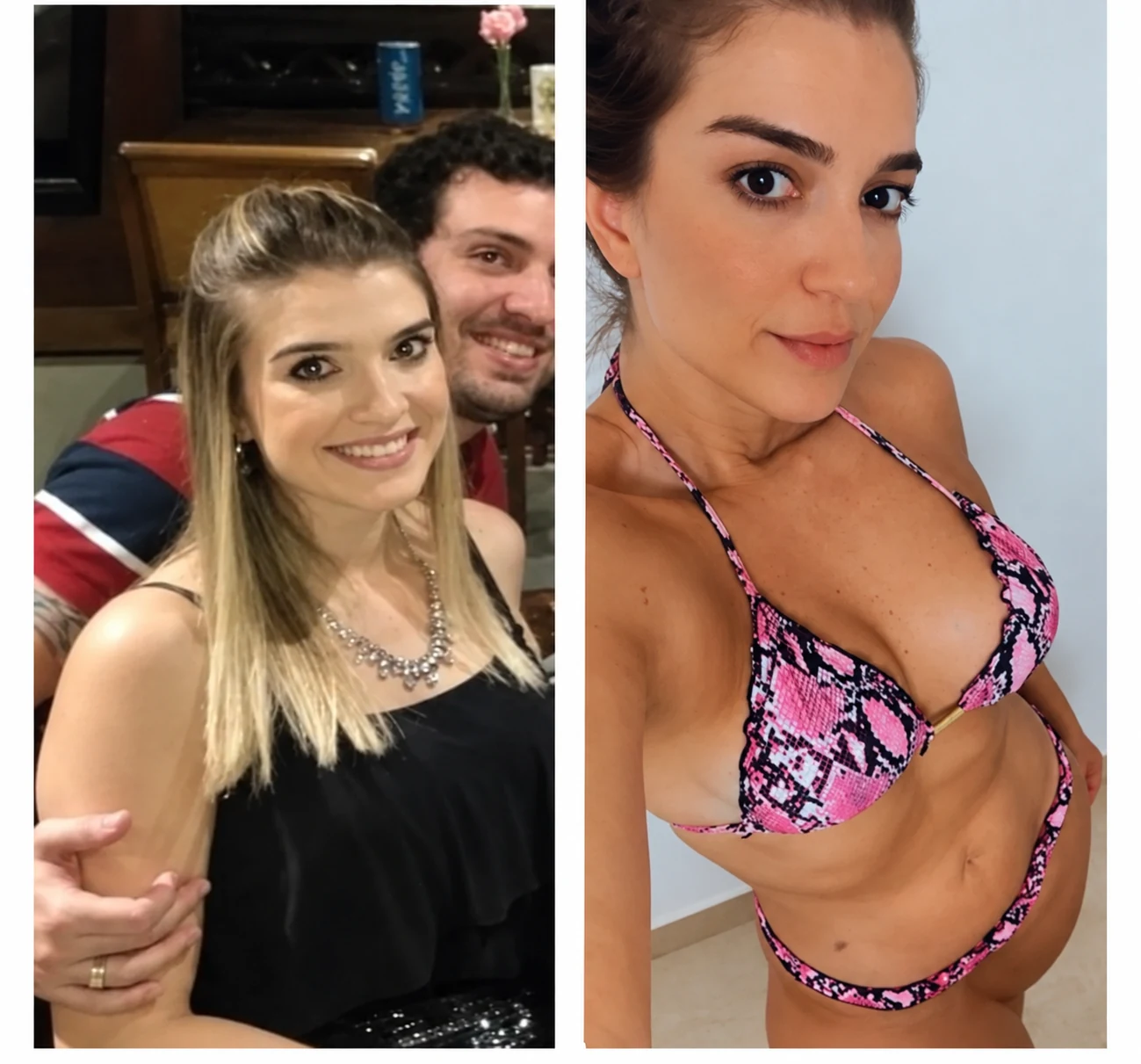 Paciente em registro de acompanhamento nutricional